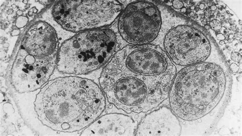  Toxoplasma gondii: Un Parassita Astuto che Controlla le Menti dei suoi Ospiti!